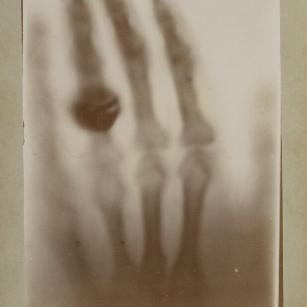 Afdruk van de röntgenfoto van de hand van Röntgens echtgenote